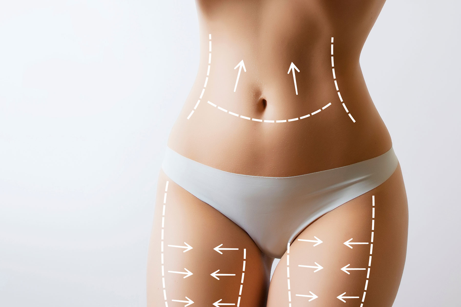Liposuzione e liposcultura: rimodellamento corpo Istanbul Turchia